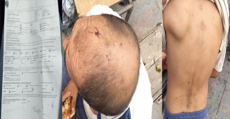 Bakım Merkezindeki Hasta Darp Raporu Aldı