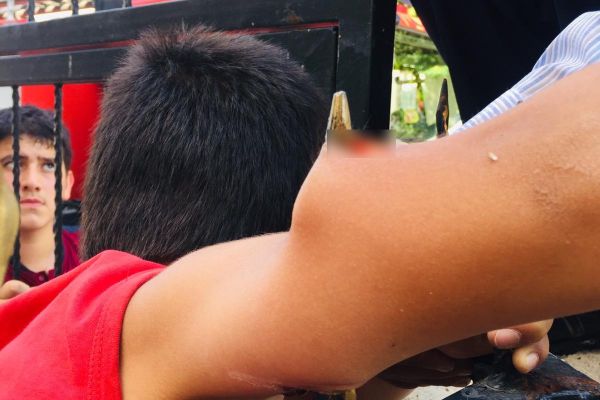 Çocuğun koluna demir korkuluk saplandı