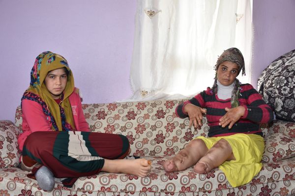 Elleri ve ayakları her geçen gün eriyor