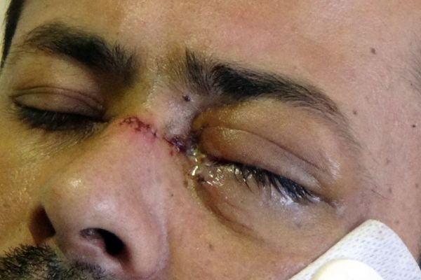 Garsonu gözünden bıçaklayan şahıs tutuklandı