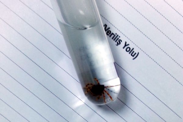 KENENİN ISIRDIĞI GENÇ KIZ HASTANEYE KALDIRILDI