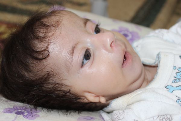 Kulakları olmayan bebek ameliyat olmayı bekliyor 