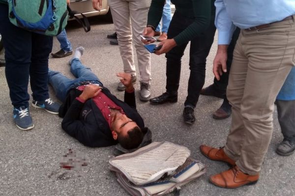 Otomobil ile motosiklet çarpıştı: 1 yaralı