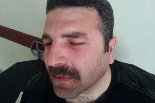 SAĞLIK ÇALIŞANINI VURDULAR..!