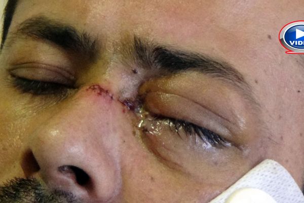 Servisi beğenmediği için garsonu gözünden eden şahıs yakalandı