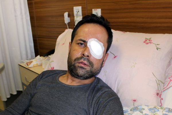 Servisi beğenmeyen müşteri garsonu gözünden etti