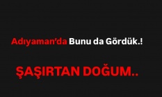 Adıyaman#039;da şaşırtan doğum olayı.!