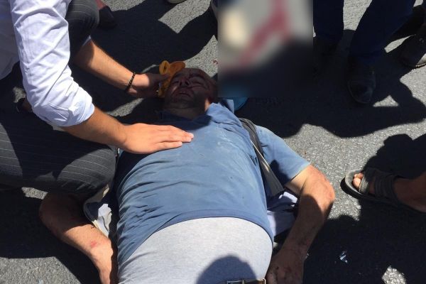 Yolcu otobüsü ile motosiklet çarpıştı: 1 yaralı