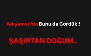 Adıyaman'da şaşırtan doğum olayı.!