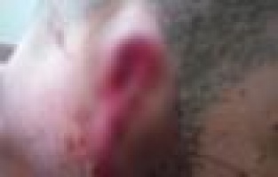 50 TL için arkadaşının kulağını ısırarak kopardığı iddiası