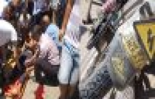 AYAKLARI PARÇALANDI, KEMİKLERİ DIŞARIYA ÇIKTI