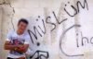 Babasının Tüfeğiyle İntihar Teşebbüsünde Bulundu