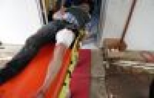  ÇOBAN SİLAHLA YARALANDI