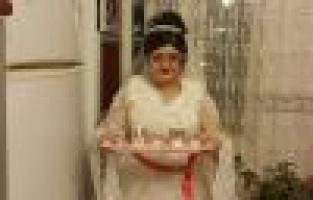 Damatsız gelinin mutluluğu dünyalara bedel