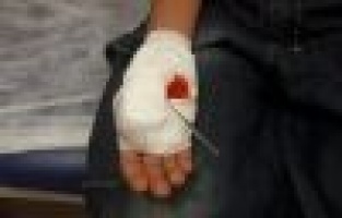 Eline saplanan şişle hastaneye getirildi