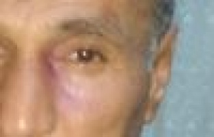 Eşini ve babası şehit olan köy korucusu saldırıya uğradı