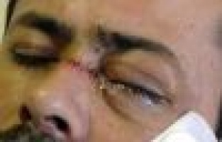 Garsonu gözünden bıçaklayan şahıs tutuklandı