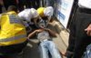 MOTOSİKLET İLE OTOMOBİL ÇARPIŞTI: 1 YARALI