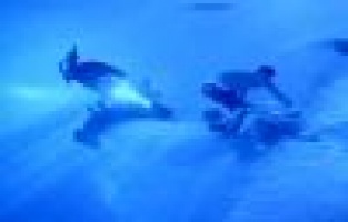 Pantolon paçası kazaya neden oldu