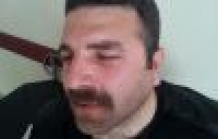SAĞLIK ÇALIŞANINI VURDULAR..!