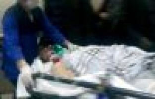 ŞİZOFRENİ HASTASI DEHŞET SAÇTI