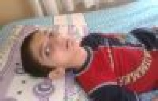 Sspe Hastası Alagöz, Yardım Bekliyor