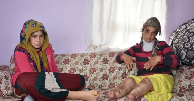 Elleri ve ayakları her geçen gün eriyor